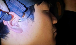 采耳的视频,探秘传统采耳技艺的视听之旅